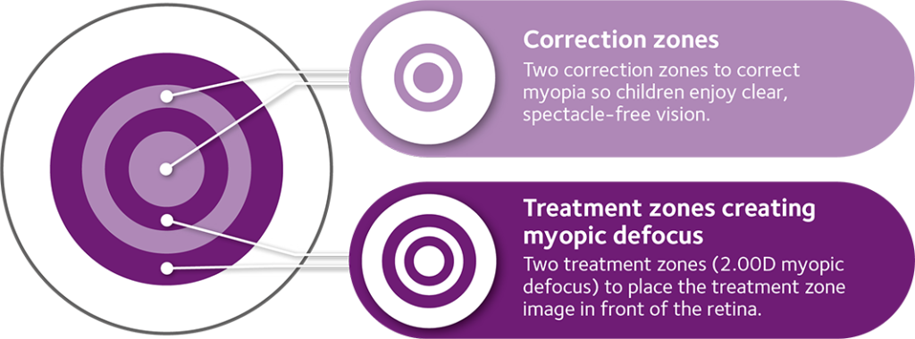 myopia lens img